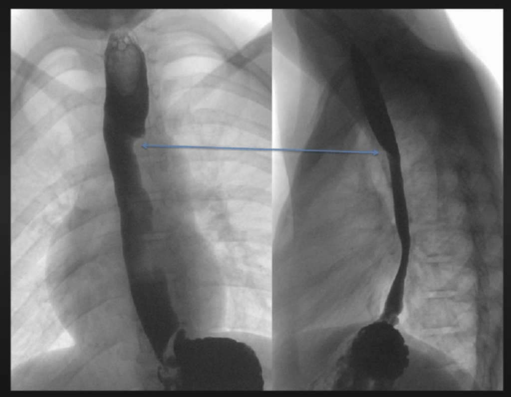 Fluoroscopy Lakes Radiology